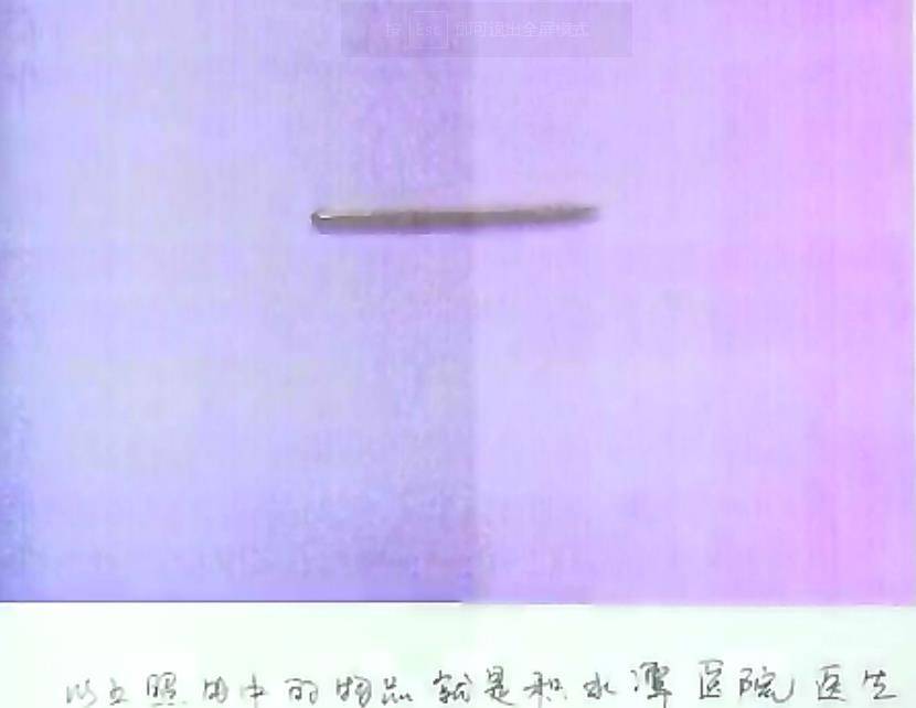 2015年保姆为报复雇主竟用钢针刺入孩子体内法院：重判(图5)