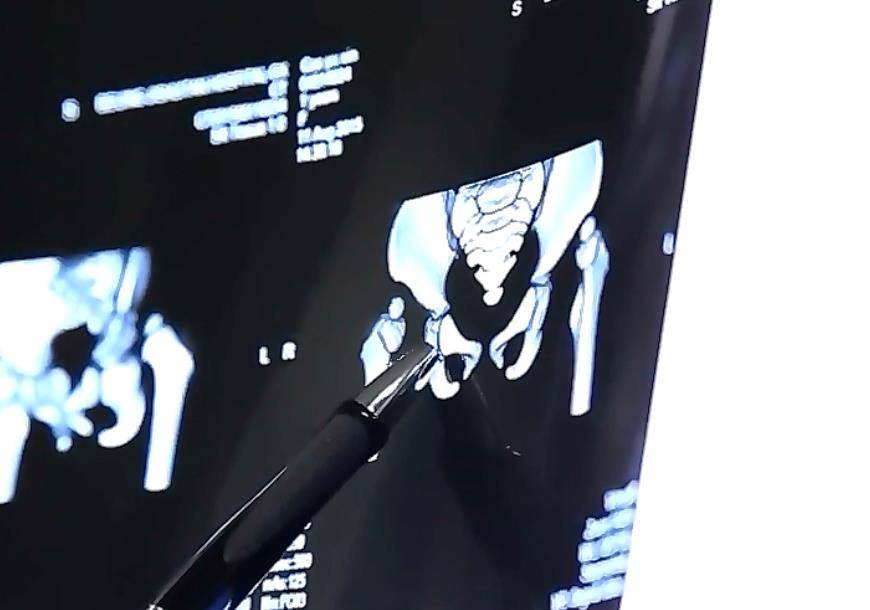 2015年保姆为报复雇主竟用钢针刺入孩子体内法院：重判(图7)